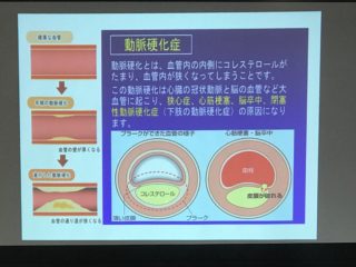 2018年12月1日（土）「冬の脳梗塞・心筋梗塞を漢方で対策」