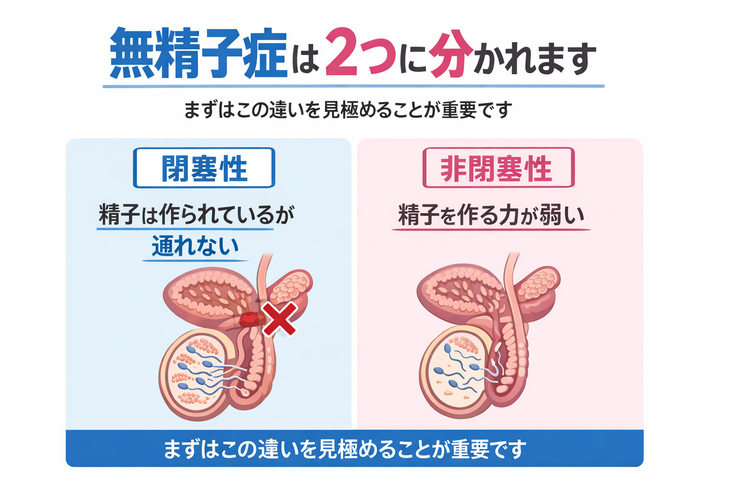 無精子症は閉塞性無精子症と非閉塞性無精子症に分かれます